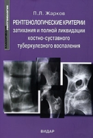 Рентгенологические критерии затихания и полной ликвидации костно-суставного туберкулезного воспаления артикул 13084d.